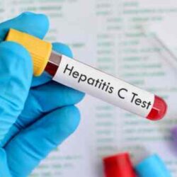 Ειδοποίηση για να εξεταστούν για ηπατίτιδα C, όλοι όσοι έχουν γεννηθεί μεταξύ 1945 – 1980